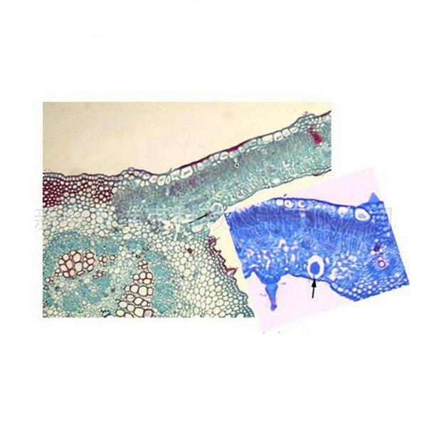 Fig Leaf, c.s. Prepared Microscope Slide