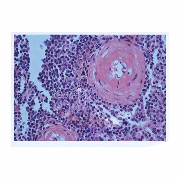 Spleen Central Small Artery Hyaline Degeneration, Microscope Slide - Dr Wong Anatomy