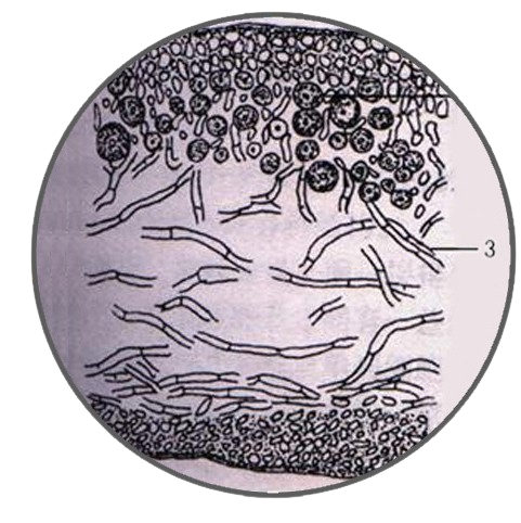 Lichen, Heteromerous Thallus, Prepared Microscope Slide