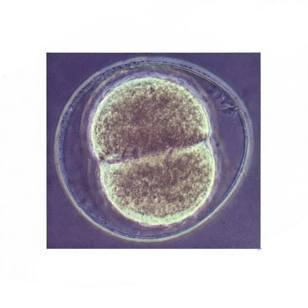 Sea Urchin Cleavage Stage, Prepared Microscope Slide