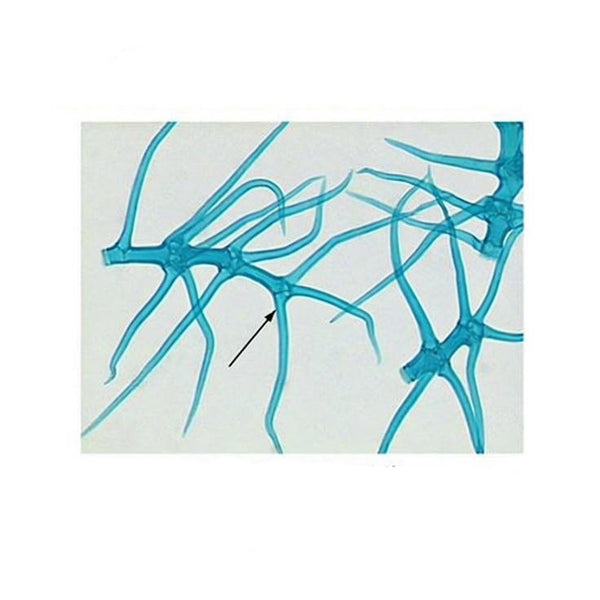 London Plane Leaf Epidermis (Branched Stellate Hairs), Prepared Microscope Slide