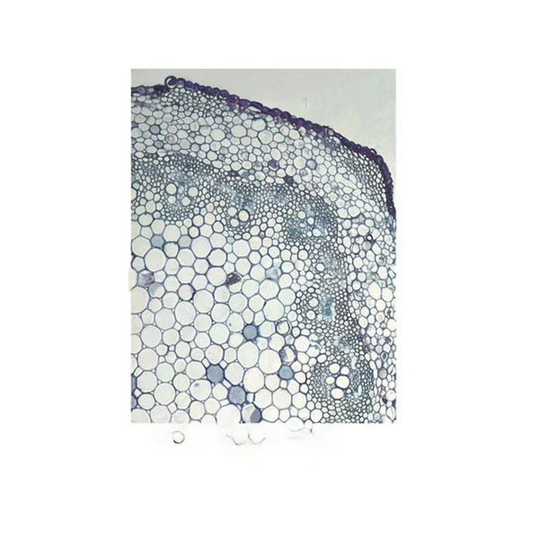 Toothed Dock Stem, c.s. Prepared Microscope Slide - Dr Wong Anatomy
