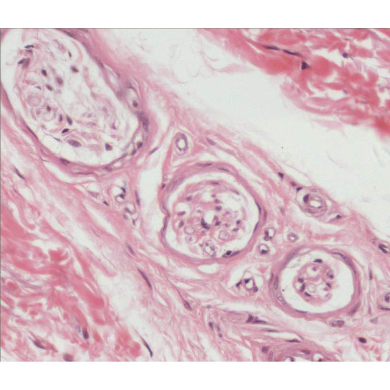 Pacinian Corpuscle, Microscope Slide - Dr Wong Anatomy