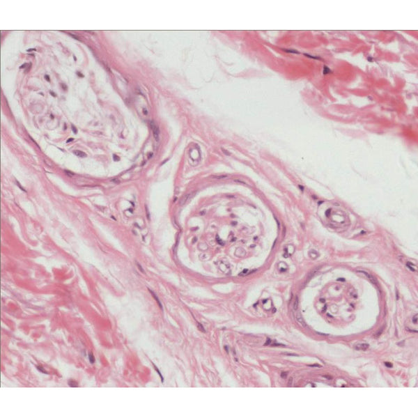 Pacinian Corpuscle, Microscope Slide - Dr Wong Anatomy