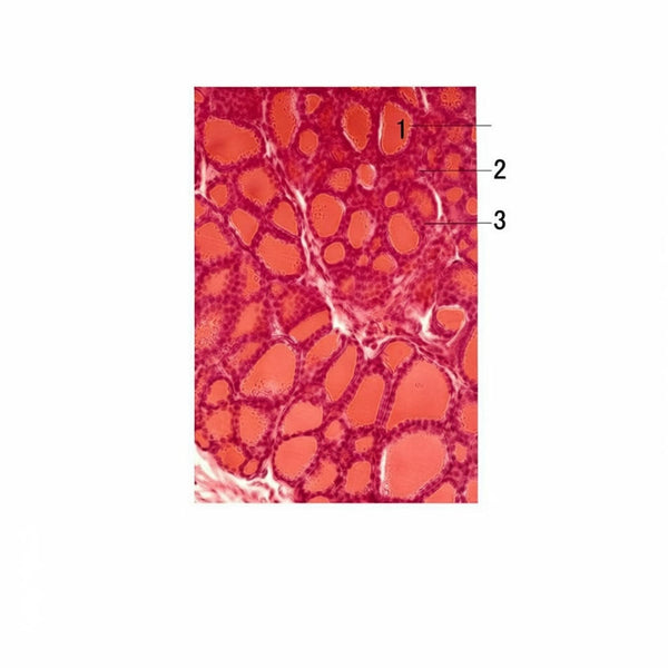 Thyroid Gland, Microscope Slide - Dr Wong Anatomy