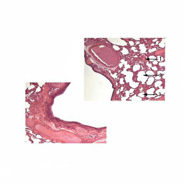 Lung, Microscope Slide - Dr Wong Anatomy