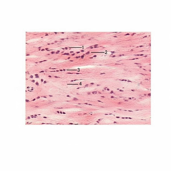 Fibrocartilage, Microscope Slide - Dr Wong Anatomy