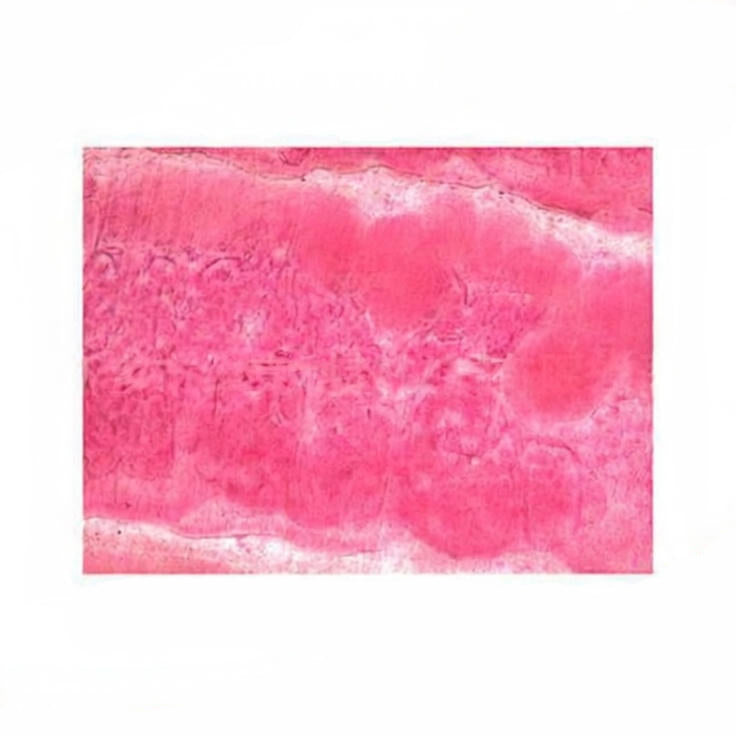 Taenia solium Immature Proglottid, Prepared Microscope Slide
