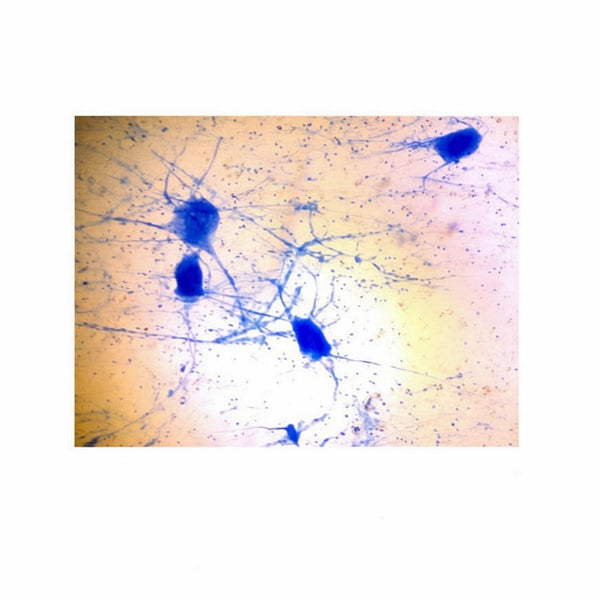 Motor Neuron, Isolated, Microscope Slide - Dr Wong Anatomy