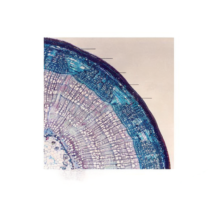 Linden Perennial Stem, c.s. Prepared Microscope Slide - Dr Wong Anatomy