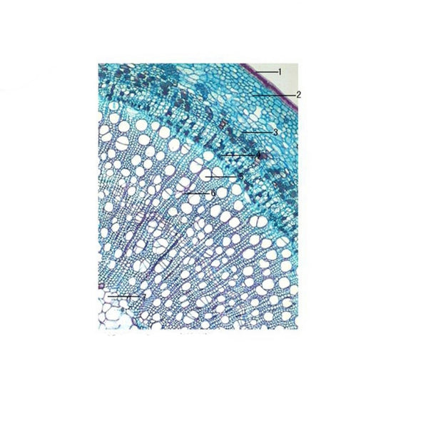 Willow Stem, c.s. Prepared Microscope Slide - Dr Wong Anatomy