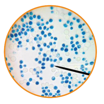 Yeast Cells, Prepared Microscope Slide