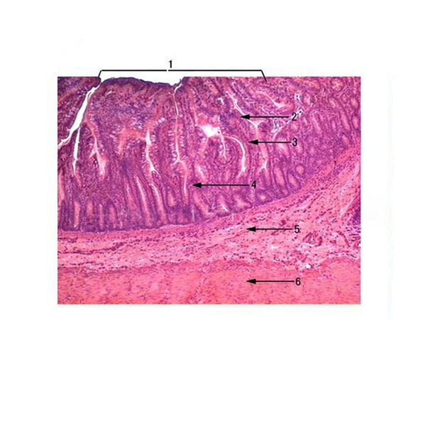 Ileum, Microscope Slide - Dr Wong Anatomy