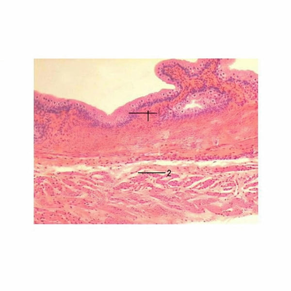Transitional Epithelium (Empty Bladder), Microscope Slide - Dr Wong Anatomy