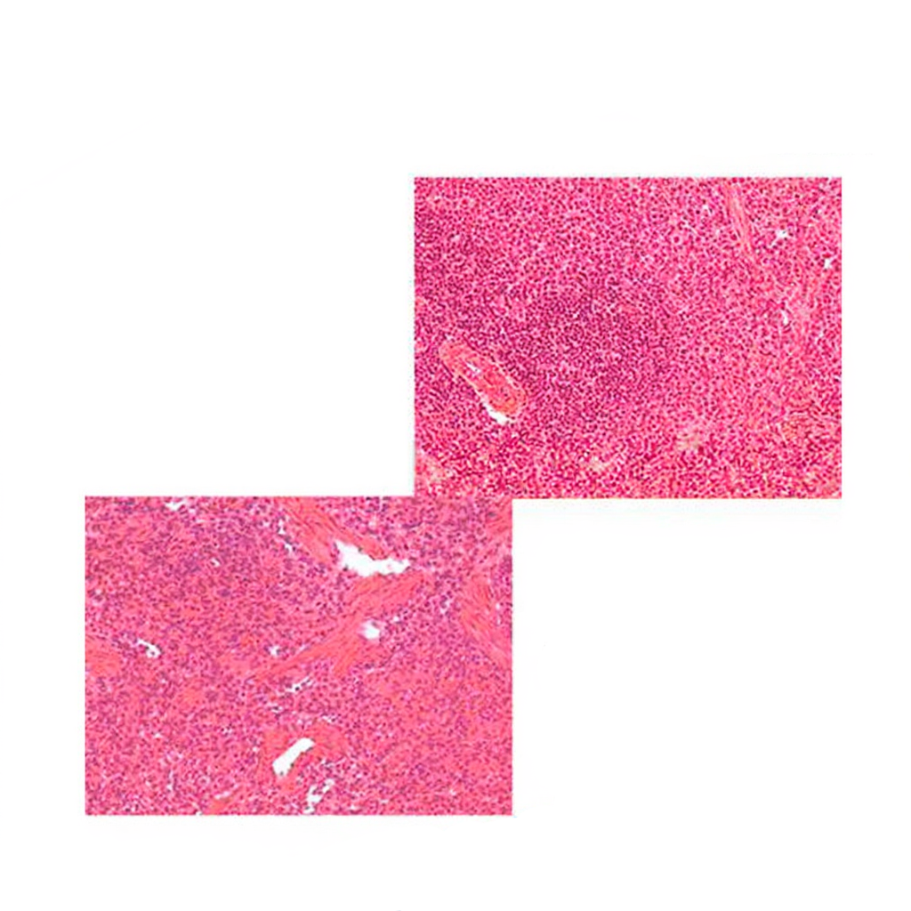 Spleen, Microscope Slide - Dr Wong Anatomy