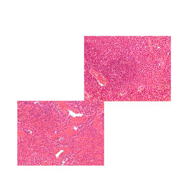 Spleen, Microscope Slide - Dr Wong Anatomy