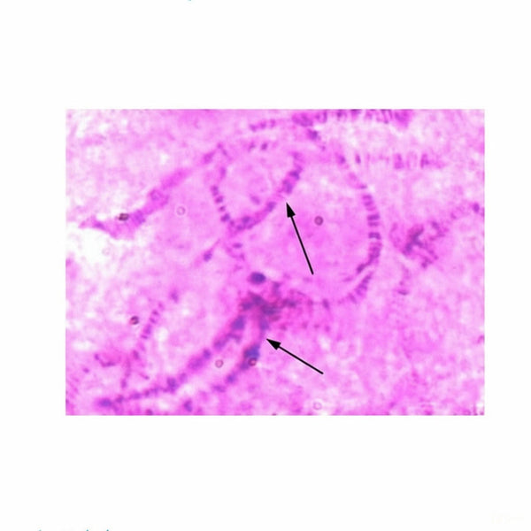 Chironomus Salivary Gland Chromosome, Microscope Slide - Dr Wong Anatomy