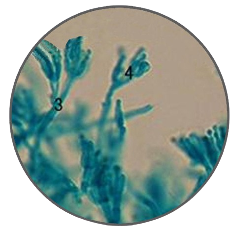Penicillium, Microscope Slide - Dr Wong Anatomy