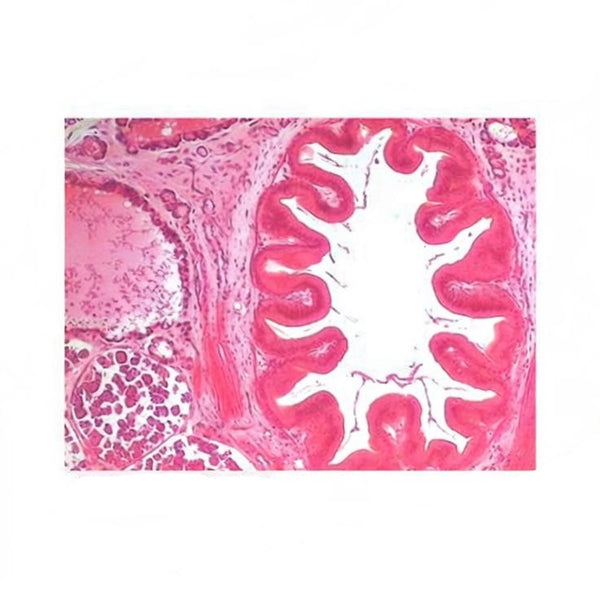 Hirudinea (Leech), c.s. Prepared Microscope Slide