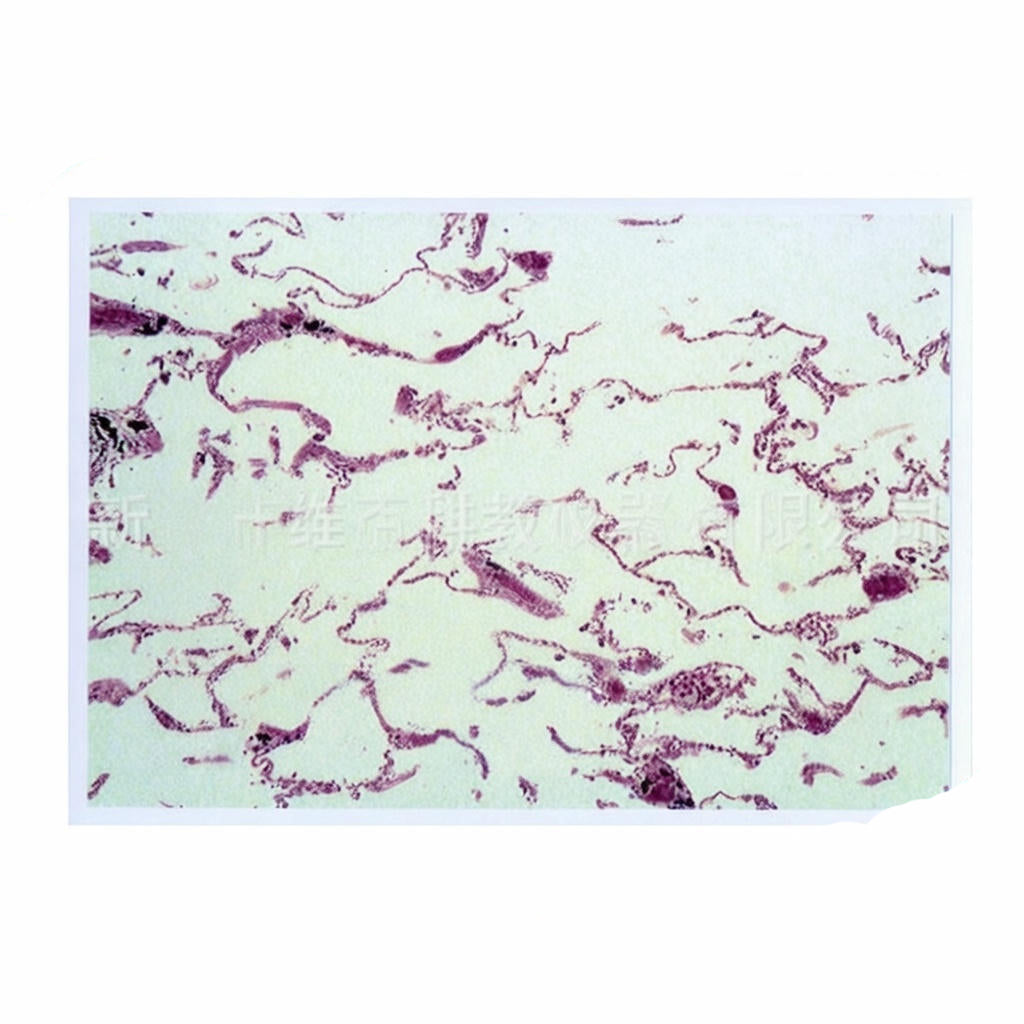 Human Emphysema Lung, Microscope Slide - Dr Wong Anatomy