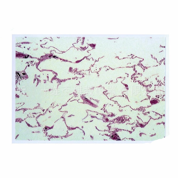 Human Emphysema Lung, Microscope Slide - Dr Wong Anatomy