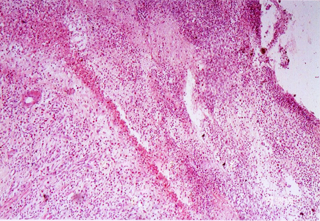 Immunohistochemistry Pathology Section Microscope Slide - Dr Wong Anatomy