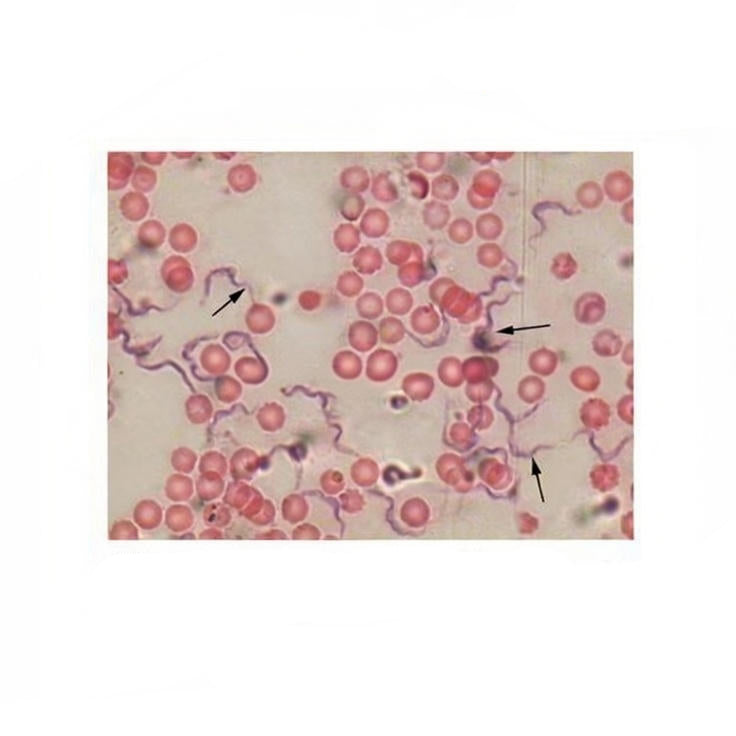 Trypanosoma Blood Smear, Microscope Slide - Dr Wong Anatomy