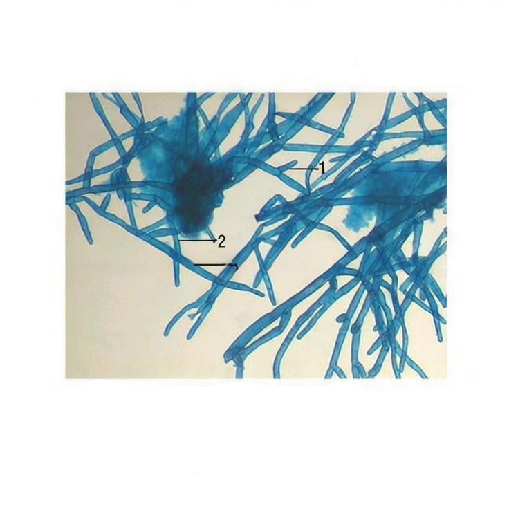 Funaria Protonema, Prepared Microscope Slide