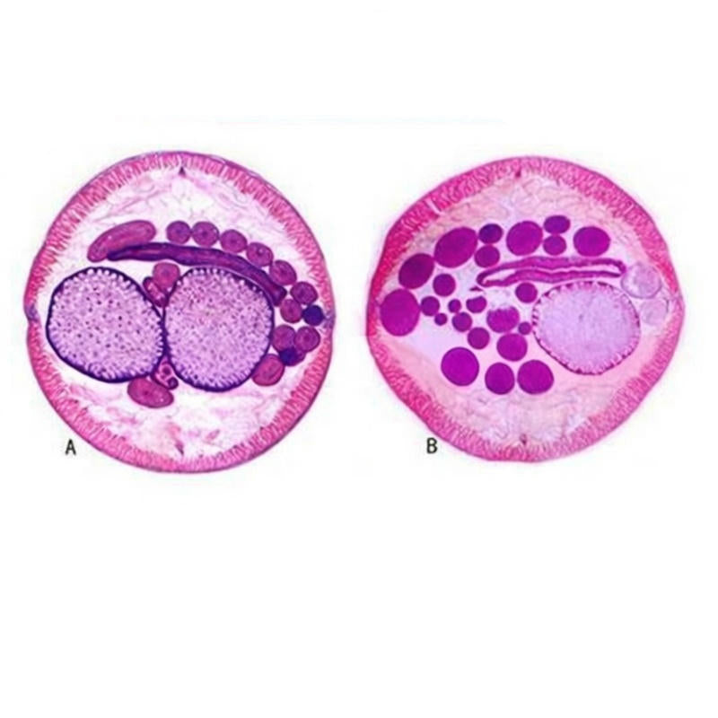 Roundworm (Ascaris) Male and Female, c.s. Prepared Microscope Slide ...