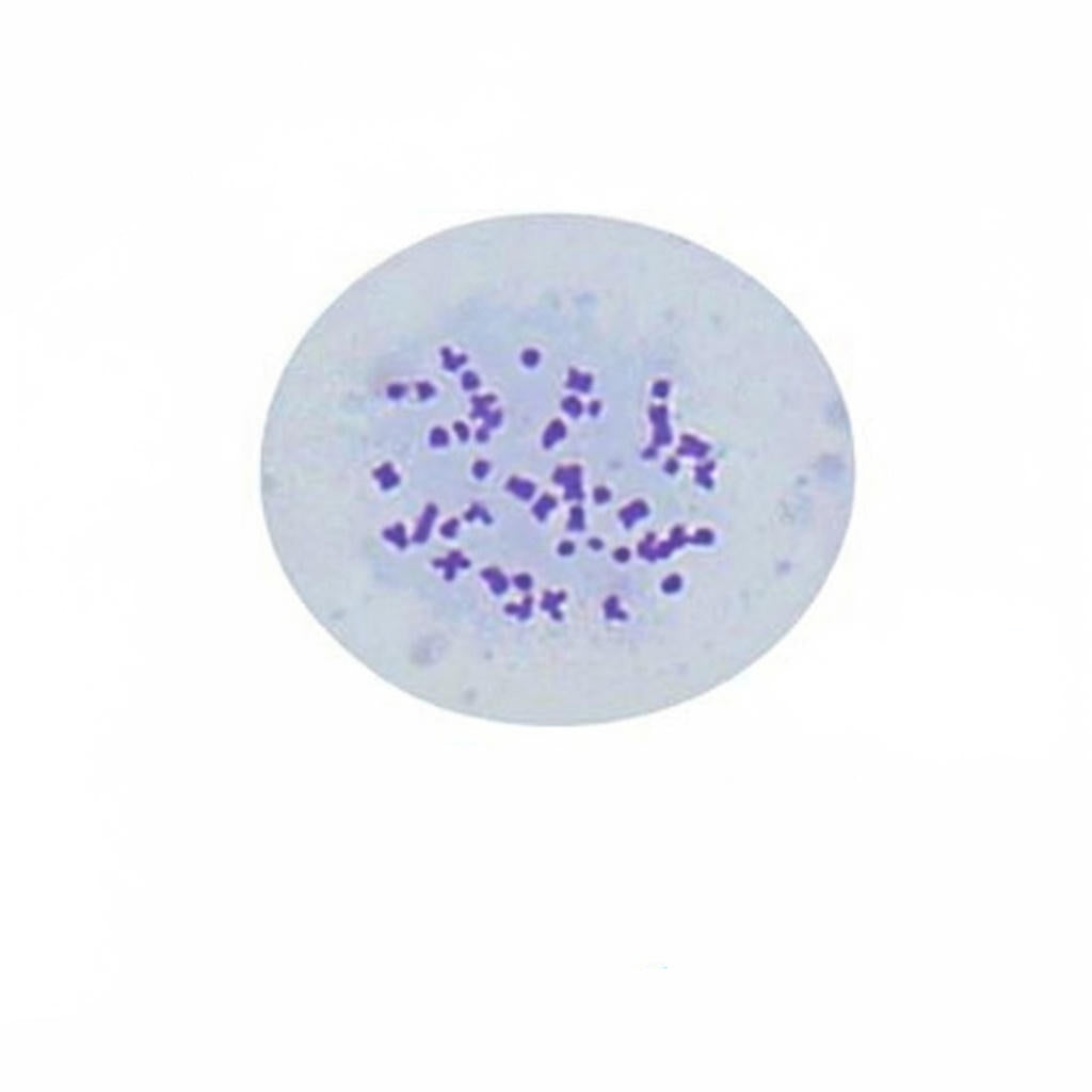 Normal Male Human Chromosome, Microscope Slide - Dr Wong Anatomy