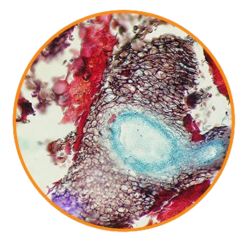 Jujube Black Rot Fungus, Prepared Microscope Slide