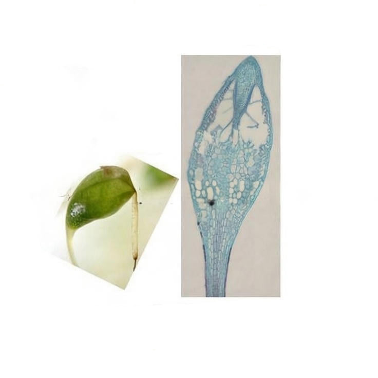 Funaria Sporophyte, l.s. Prepared Microscope Slide