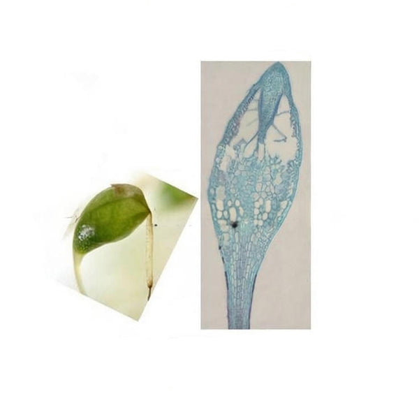 Funaria Sporophyte, l.s. Prepared Microscope Slide