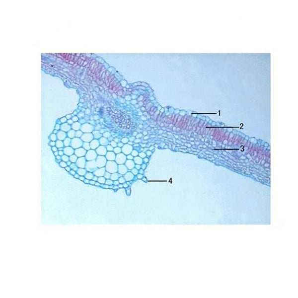Potato Leaf, c.s. Prepared Microscope Slide