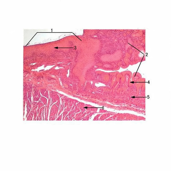 Esophagus-Cardia Junction, Microscope Slide - Dr Wong Anatomy