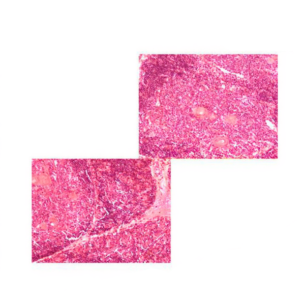 Pig Thymus, Microscope Slide - Dr Wong Anatomy