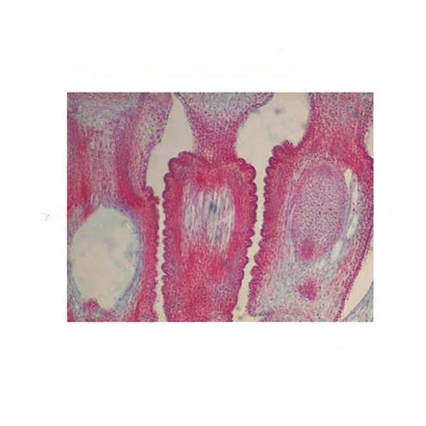 Dandelion Floret, l.s. Prepared Microscope Slide - Dr Wong Anatomy