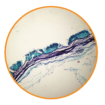 Grape Anthracnose Fungus (Colletotrichum), Prepared Microscope Slide