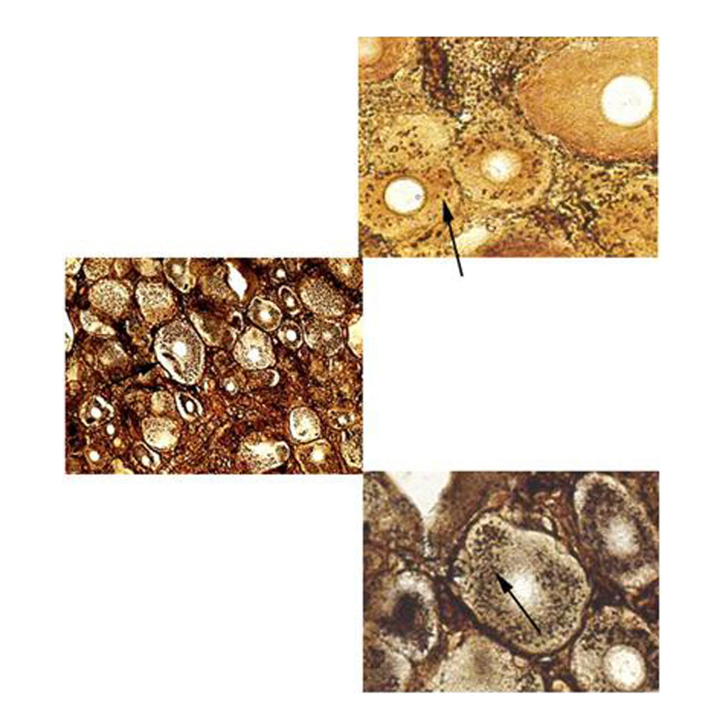 Spinal Ganglion, Microscope Slide - Dr Wong Anatomy