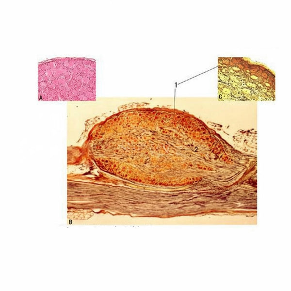 Spinal Ganglion, Microscope Slide - Dr Wong Anatomy