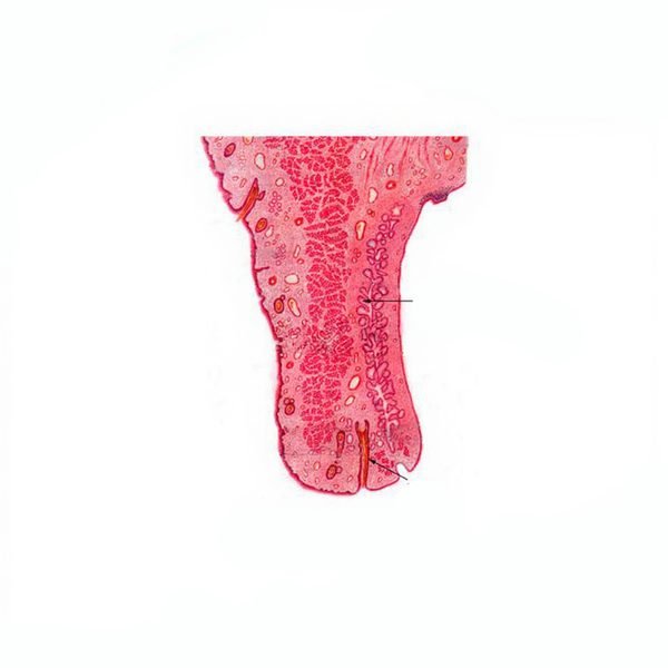 Eyelid, sagittal section Microscope Slide - Dr Wong Anatomy