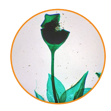 Fern Prothallus with Young Sporophyte, Prepared Microscope Slide