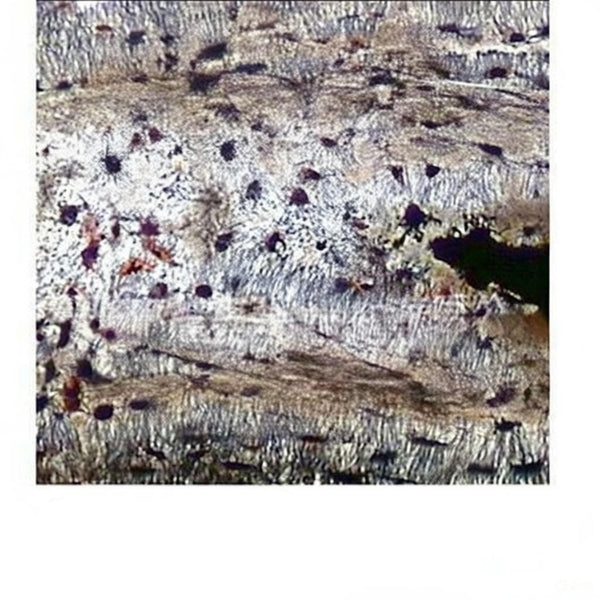 Hard Bone Ground Section, l.s. Microscope Slide - Dr Wong Anatomy