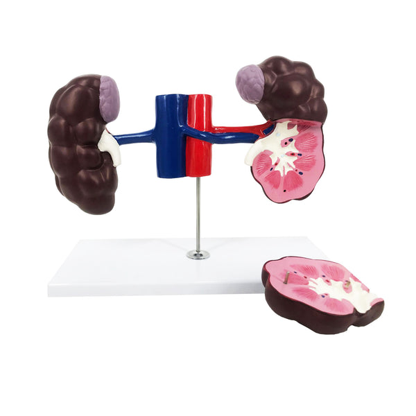 Bovine Kidney Model