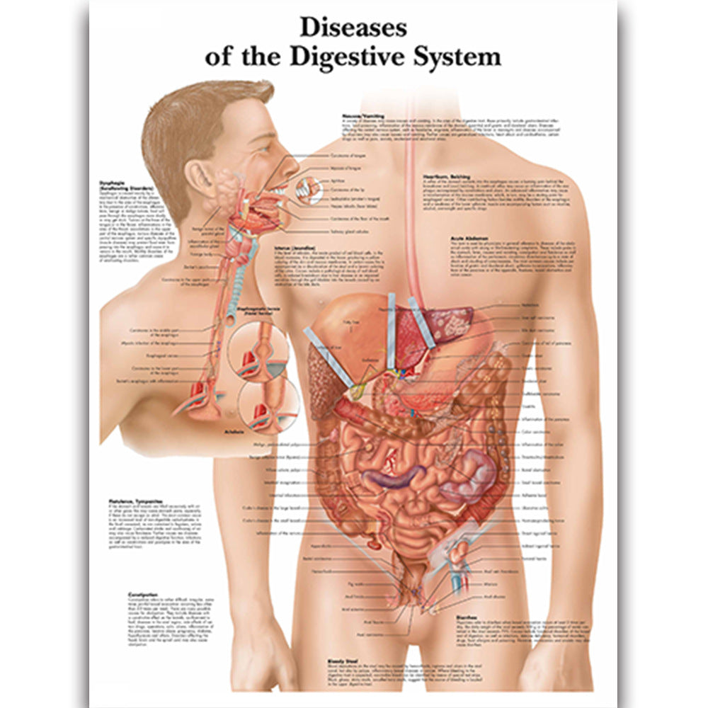 Diseases of the Digestive System Chart - Dr Wong Anatomy