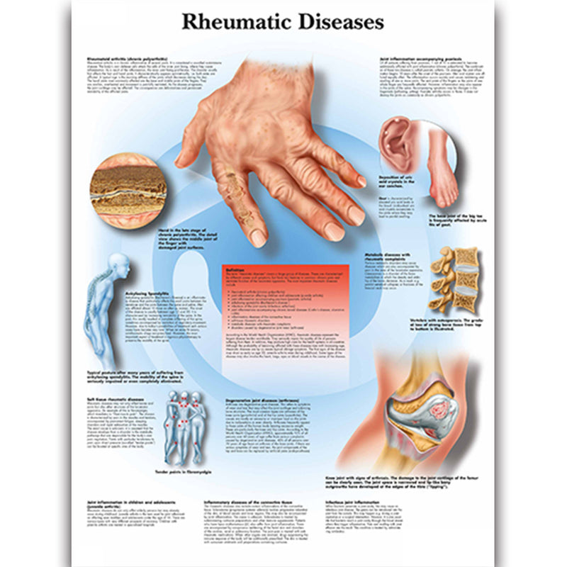Health Education Chart Rheumatic Diseases
