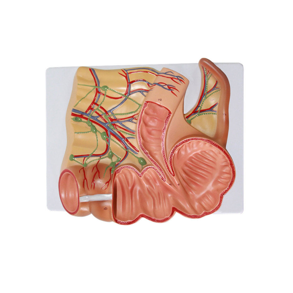 Caecum and Appendix Model, 2X Life-Size - Dr Wong Anatomy