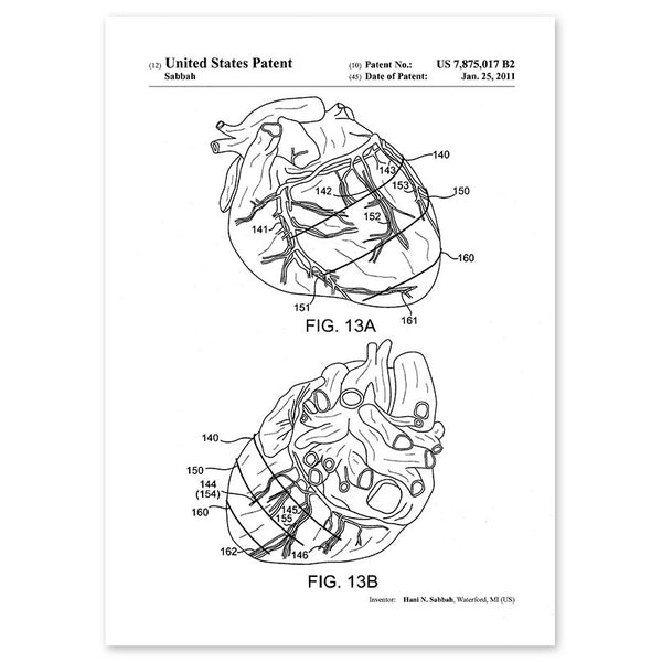 Anatomy Art Print - Heart