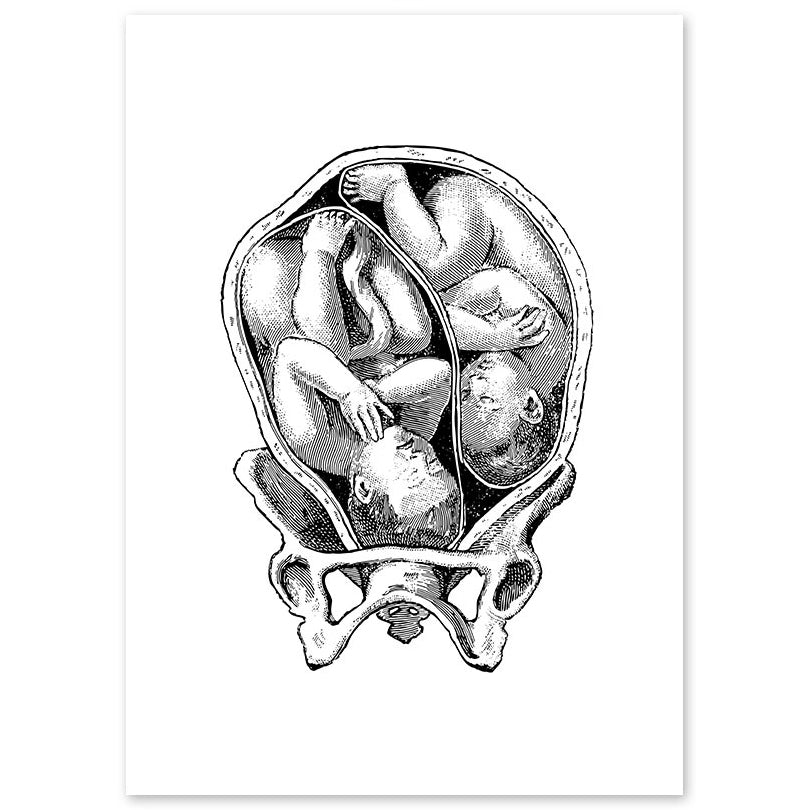 Anatomy Art Print - Fetus