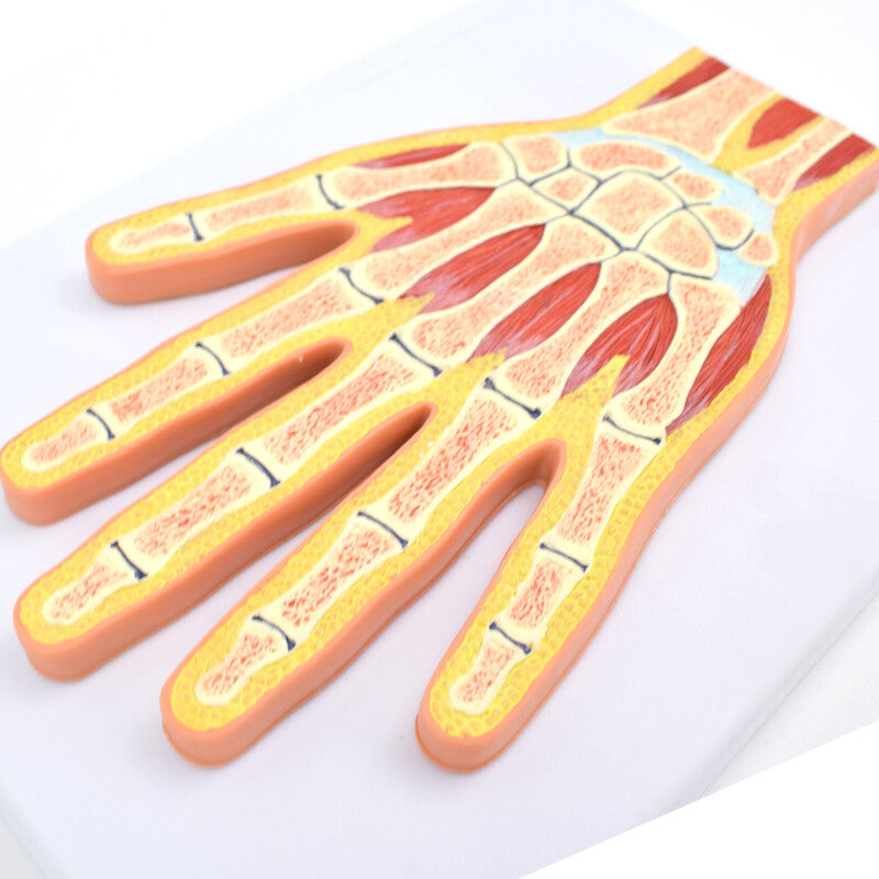 Normal Variant Hand Os Normal Hand Section Model, Life-Size – Dr Wong Anatomy